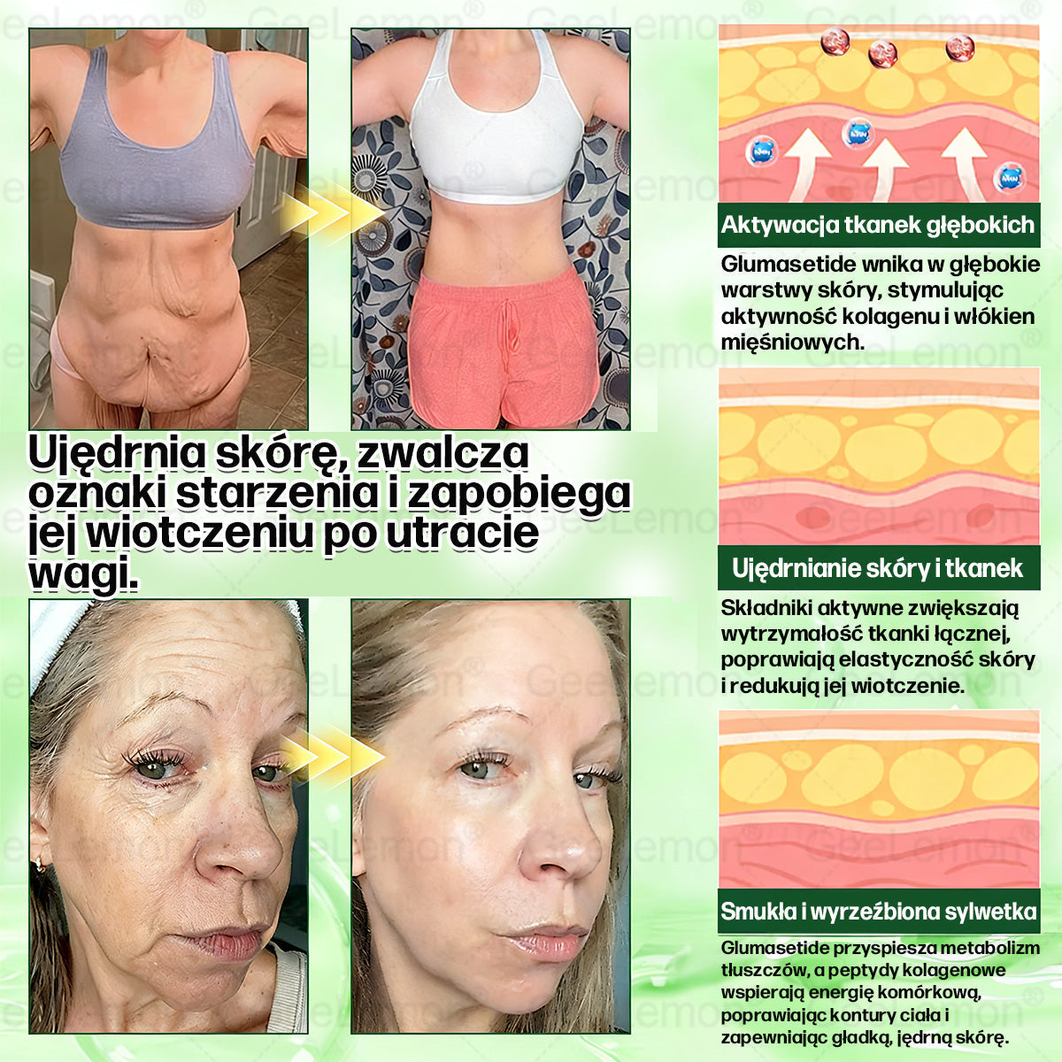 Oficjalny Sklep | 👩‍⚕️🎁 𝐆𝐞𝑒𝐿𝑒𝐦𝐨𝐧® 𝐆𝐥𝐮𝐦ase𝐭𝐢𝐝𝐞 𝟖 𝐰 𝟏 Smukły i Zdrowy Nano Plaster z Mikronakłuciami 🇵🇱(Tylko raz dziennie, widoczne zmiany już w 7 dni)✅ Na otyłość, 🅛🅞🅞🅢🅔 🅢🅚🅘🅝 wiotką skórę, cukrzycę, bezdech senny, problemy ze stawami i wiele więcej pltp03