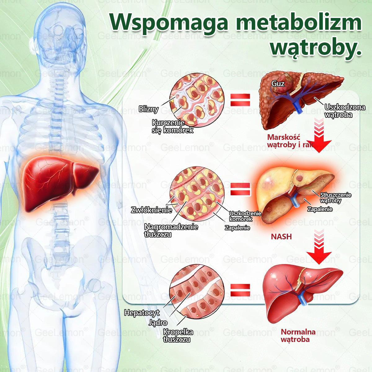 Oficjalny Sklep | 👩‍⚕️🎁 𝐆𝐞𝑒𝐿𝑒𝐦𝐨𝐧® 𝐆𝐥𝐮𝐦ase𝐭𝐢𝐝𝐞 𝟖 𝐰 𝟏 Smukły i Zdrowy Nano Plaster z Mikronakłuciami 🇵🇱(Tylko raz dziennie, widoczne zmiany już w 7 dni)✅ Na otyłość, 🅛🅞🅞🅢🅔 🅢🅚🅘🅝 wiotką skórę, cukrzycę, bezdech senny, problemy ze stawami i wiele więcej pltp03