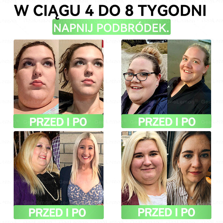 Oficjalny Sklep | 👩‍⚕️🎁 𝐆𝐞𝑒𝐿𝑒𝐦𝐨𝐧® 𝐆𝐥𝐮𝐦ase𝐭𝐢𝐝𝐞 𝟖 𝐰 𝟏 Smukły i Zdrowy Nano Plaster z Mikronakłuciami 🇵🇱(Tylko raz dziennie, widoczne zmiany już w 7 dni)✅ Na otyłość, 🅛🅞🅞🅢🅔 🅢🅚🅘🅝 wiotką skórę, cukrzycę, bezdech senny, problemy ze stawami i wiele więcej pltp03