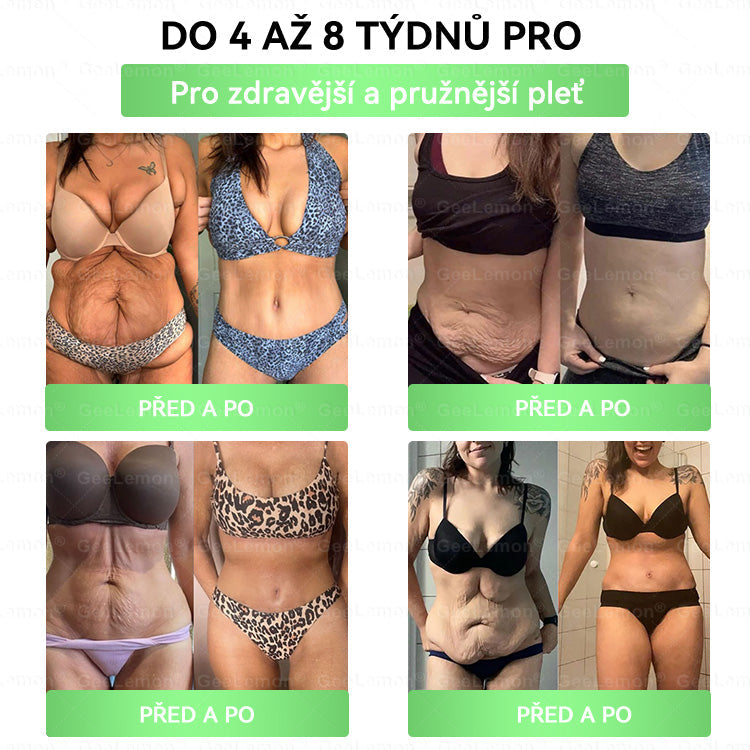 🎁 Zbývá už jen 5 balení! Nyní vám dáváme dalších 50 % slevy! Buďte fit a zdraví. Pokud tuto příležitost nevyužijete nyní, příště na ni budete mít šanci až příští rok!