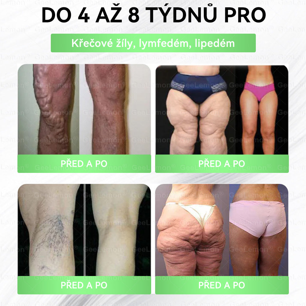 🎁 Zbývá už jen 5 balení! Nyní vám dáváme dalších 50 % slevy! Buďte fit a zdraví. Pokud tuto příležitost nevyužijete nyní, příště na ni budete mít šanci až příští rok!