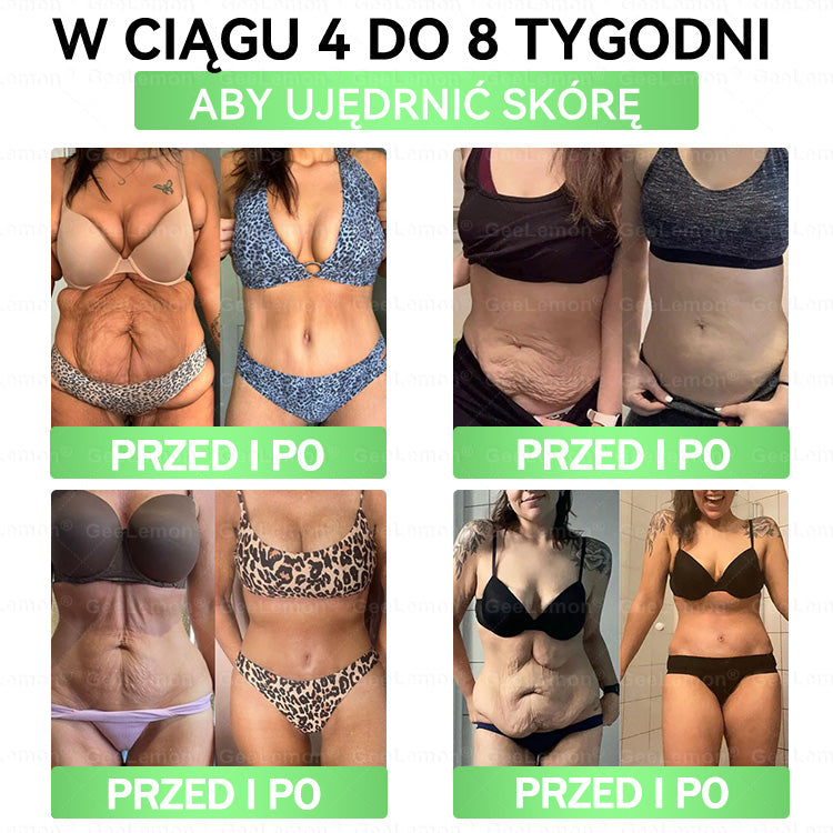 Oficjalny Sklep | 👩‍⚕️🎁 𝐆𝐞𝑒𝐿𝑒𝐦𝐨𝐧® 𝐆𝐥𝐮𝐦ase𝐭𝐢𝐝𝐞 𝟖 𝐰 𝟏 Smukły i Zdrowy Nano Plaster z Mikronakłuciami 🇵🇱(Tylko raz dziennie, widoczne zmiany już w 7 dni)✅ Na otyłość, 🅛🅞🅞🅢🅔 🅢🅚🅘🅝 wiotką skórę, cukrzycę, bezdech senny, problemy ze stawami i wiele więcej pltp03