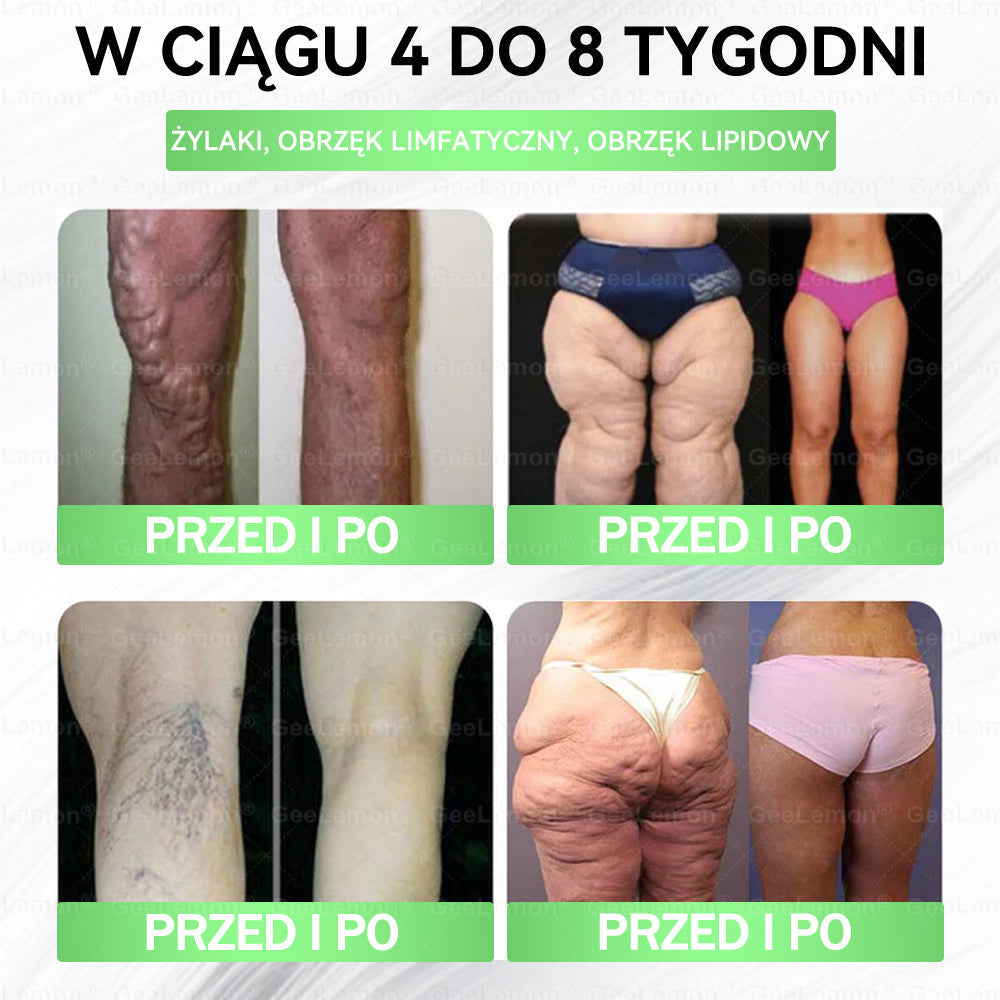 Oficjalny Sklep | 👩‍⚕️🎁 𝐆𝐞𝑒𝐿𝑒𝐦𝐨𝐧® 𝐆𝐥𝐮𝐦ase𝐭𝐢𝐝𝐞 𝟖 𝐰 𝟏 Smukły i Zdrowy Nano Plaster z Mikronakłuciami 🇵🇱(Tylko raz dziennie, widoczne zmiany już w 7 dni)✅ Na otyłość, 🅛🅞🅞🅢🅔 🅢🅚🅘🅝 wiotką skórę, cukrzycę, bezdech senny, problemy ze stawami i wiele więcej pltp03