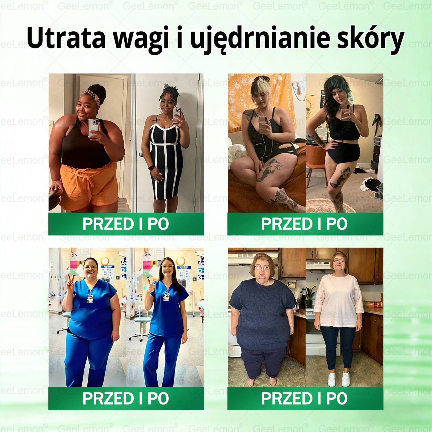 Oficjalny Sklep | 👩‍⚕️🎁 𝐆𝐞𝑒𝐿𝑒𝐦𝐨𝐧® 𝐆𝐥𝐮𝐦ase𝐭𝐢𝐝𝐞 𝟖 𝐰 𝟏 Smukły i Zdrowy Nano Plaster z Mikronakłuciami 🇵🇱(Tylko raz dziennie, widoczne zmiany już w 7 dni)✅ Na otyłość, 🅛🅞🅞🅢🅔 🅢🅚🅘🅝 wiotką skórę, cukrzycę, bezdech senny, problemy ze stawami i wiele więcej pltp03